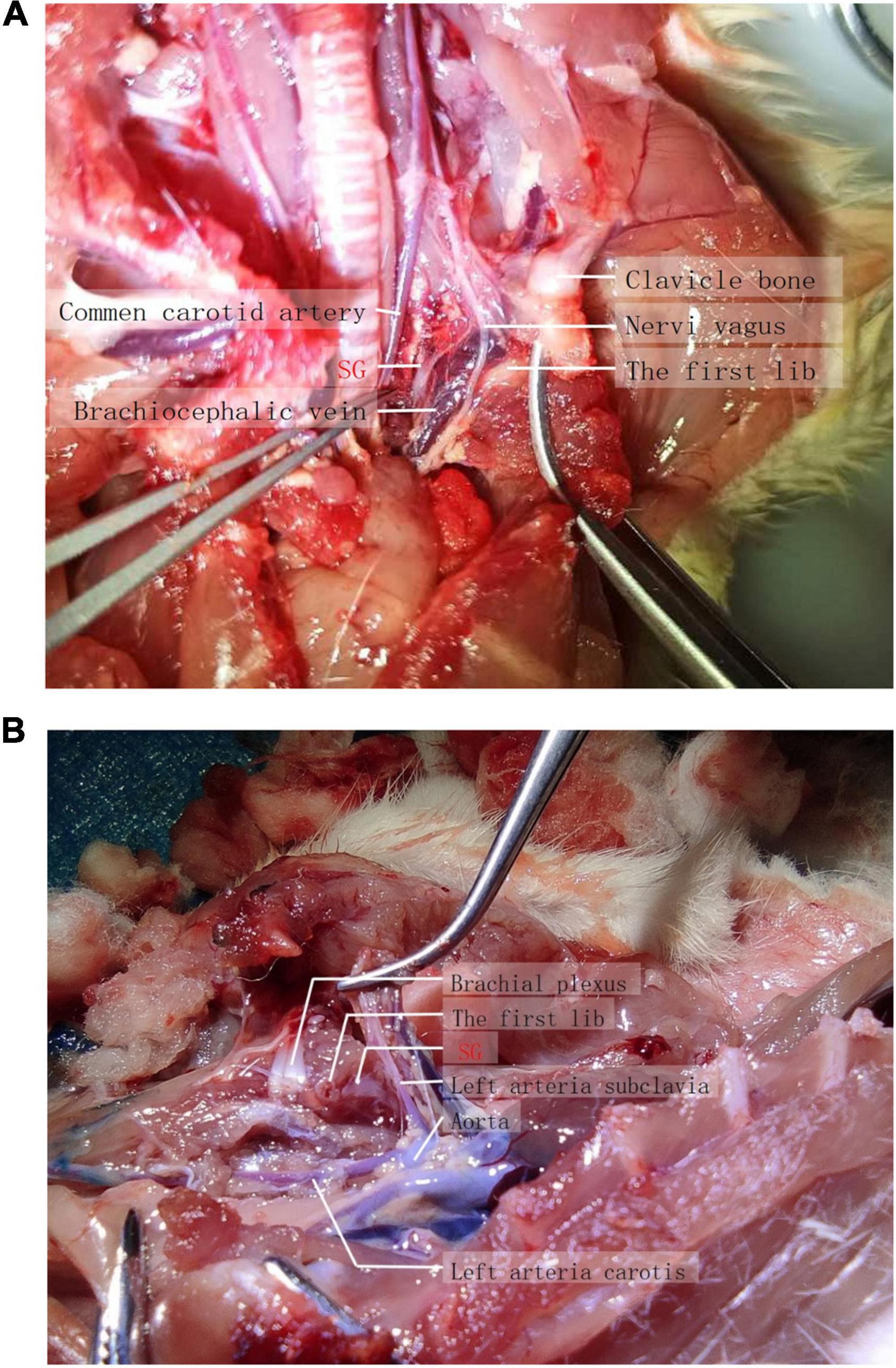 Establishment of ultrasound-guided stellate ganglion block in rats